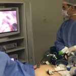 Cirurgia Bariátrica com Pinça Seladora de Caiman